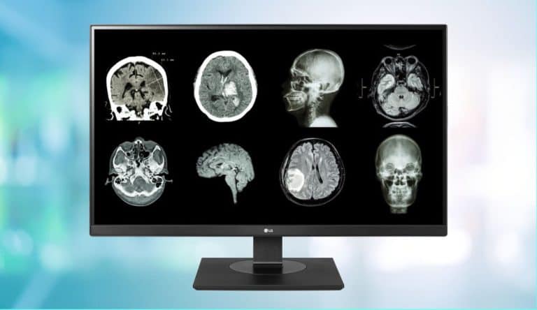 Monitors voor een niche: schermen in de medische wereld