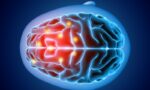 Elon Musk’s Neuralink mag op mensen getest worden